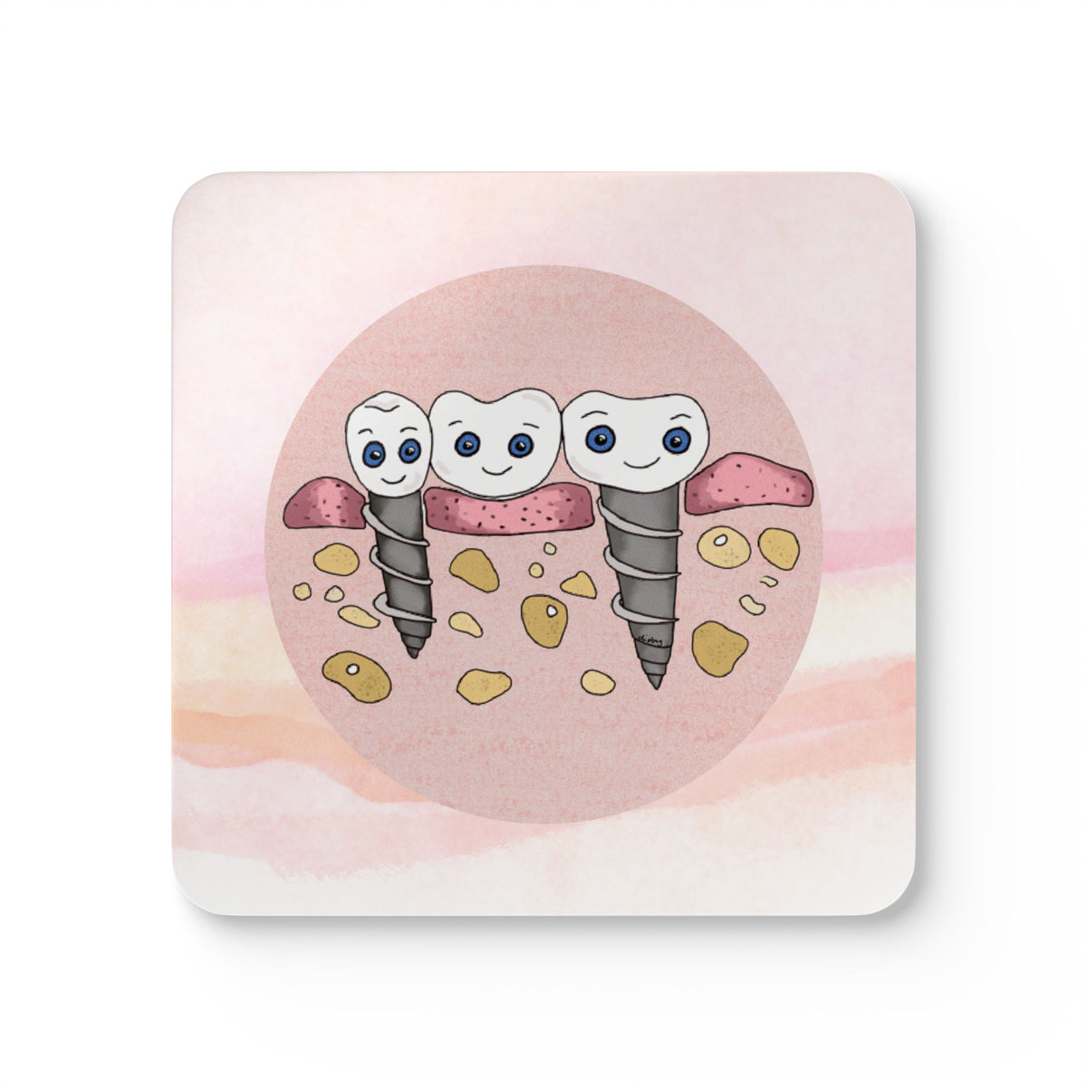 Implant Bridge Coaster Set